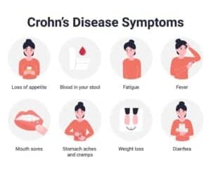 Boala crohn: Simptome, tratament si produse naturiste Calivita - adjuvante in terapia bolii 8 Boala crohn: Simptome, tratament si produse naturiste Calivita - adjuvante in terapia bolii