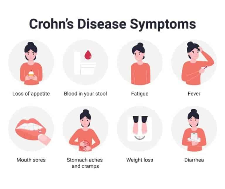 Boala crohn: Simptome, tratament si produse naturiste Calivita - adjuvante in terapia bolii 3 Boala crohn: Simptome, tratament si produse naturiste Calivita - adjuvante in terapia bolii